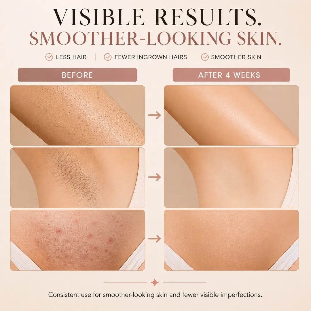 RadianceSilk™ Pro: IPL Hair Removal