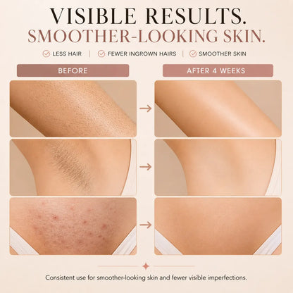 RadianceSilk™ Pro: IPL Hair Removal