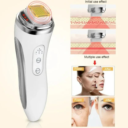 RadianceLift RF | Advanced Skin Rejuvenation Technology