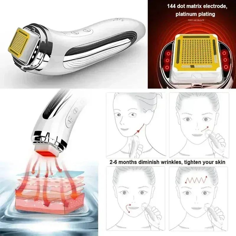 RadianceLift RF | Advanced Skin Rejuvenation Technology